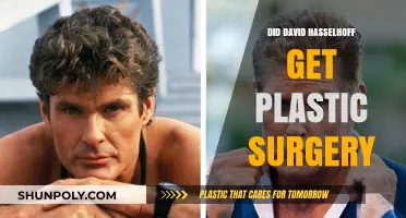 Did David Hasselhoff Undergo Plastic Surgery? Unveiling the Truth