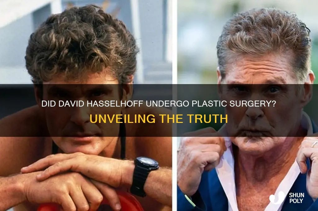 did david hasselhoff get plastic surgery