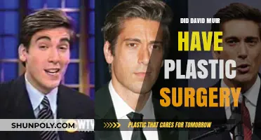 David Muir Plastic Surgery: Fact-Checking the Rumors and Speculations