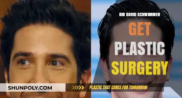 David Schwimmer's Transformation: Plastic Surgery Rumors Explored