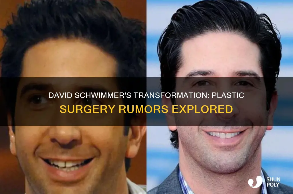 did david schwimmer get plastic surgery