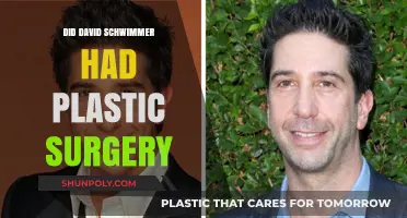 David Schwimmer Plastic Surgery: Fact or Fiction? Uncovering the Truth