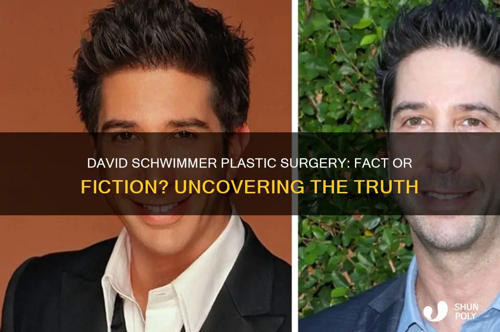 did david schwimmer had plastic surgery
