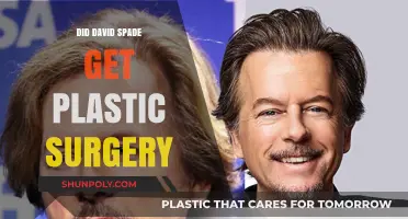 David Spade's Transformation: Plastic Surgery Rumors and Speculations