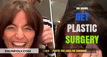 Did Davina Undergo Plastic Surgery? Uncovering the Truth Behind Her Look