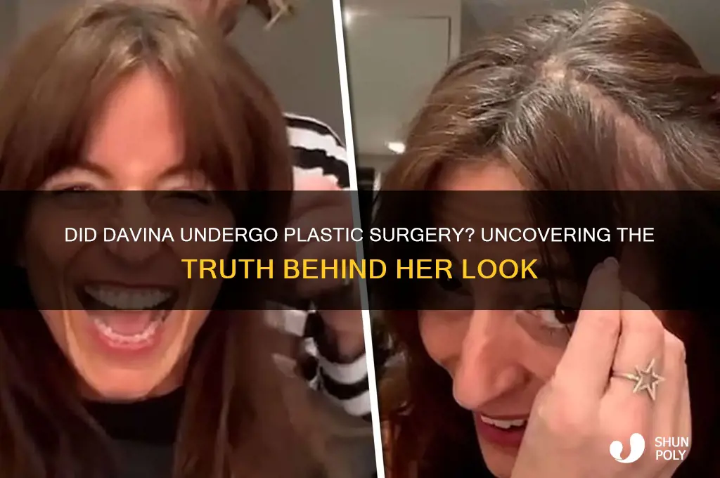 did davina get plastic surgery
