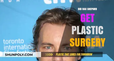 Dax Shepard Plastic Surgery: Fact-Checking the Rumors and Speculations