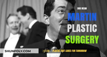 Dean Martin's Plastic Surgery: Unveiling the Truth Behind the Rumors