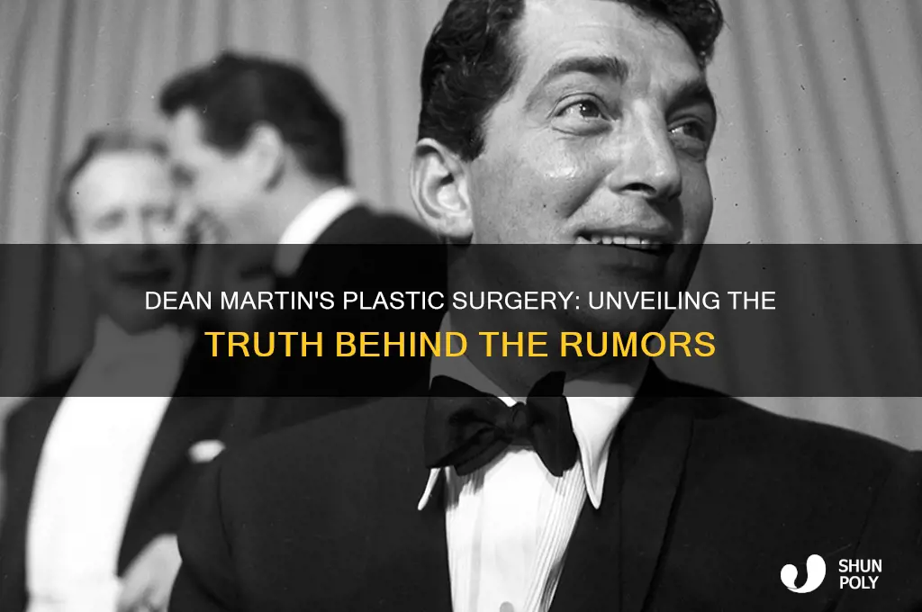 did dean martin plastic surgery