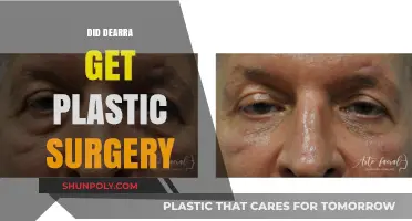 Did De'arra Get Plastic Surgery? Unveiling the Truth Behind Her Transformation