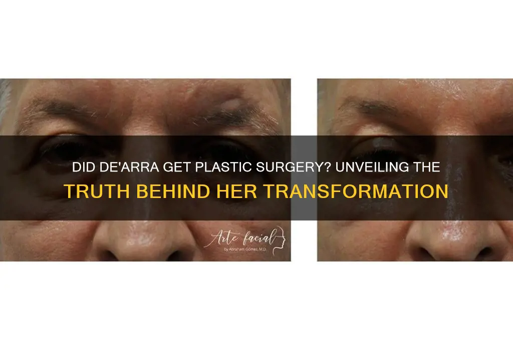 did dearra get plastic surgery