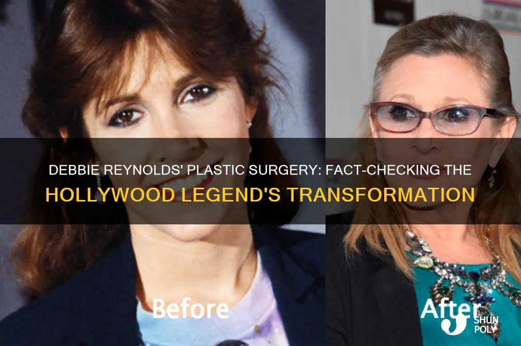 did debbie reynolds have plastic surgery