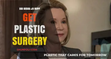 Debra Jo Rupp's Transformation: Plastic Surgery Speculations Explored