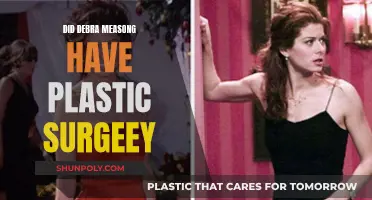 Debra Messing's Plastic Surgery: Did She or Didn't She?