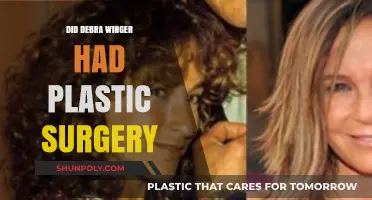 Debra Winger's Transformation: Plastic Surgery Rumors Explored