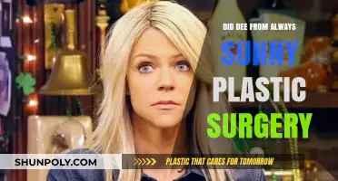 Did Dee from It's Always Sunny Get Plastic Surgery?