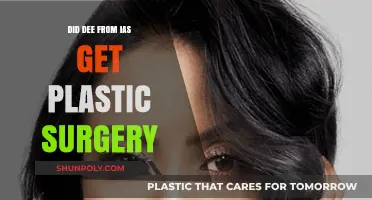 Did Dee from IAS Undergo Plastic Surgery? Unveiling the Truth