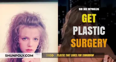 Did Dee Reynolds Undergo Plastic Surgery? Unraveling the Rumors