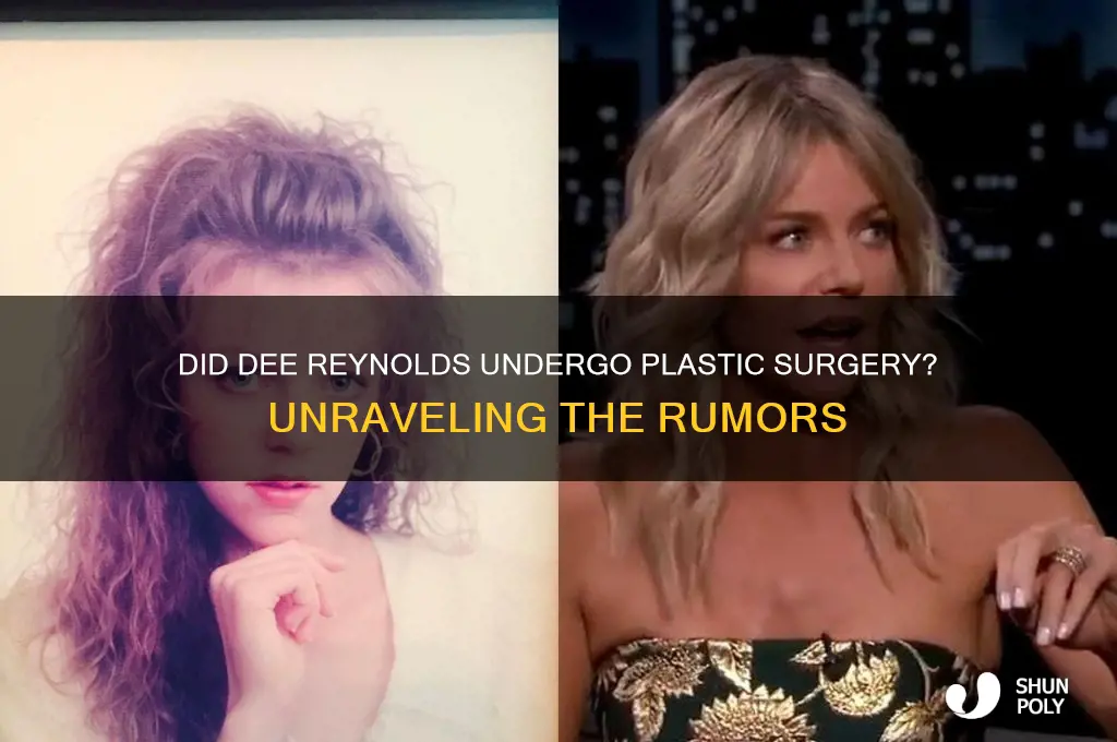 did dee reynolds get plastic surgery