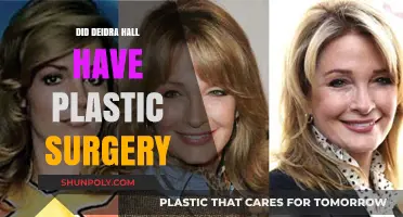 Deidre Hall's Transformation: Plastic Surgery Rumors Explored and Debunked