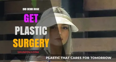 Did Demi Rose Undergo Plastic Surgery? Unveiling the Truth