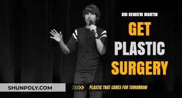 Did Demetri Martin Undergo Plastic Surgery? Unveiling the Truth