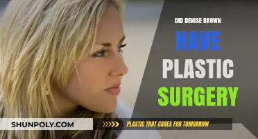 Denise Brown Plastic Surgery: Unveiling the Truth Behind Her Appearance