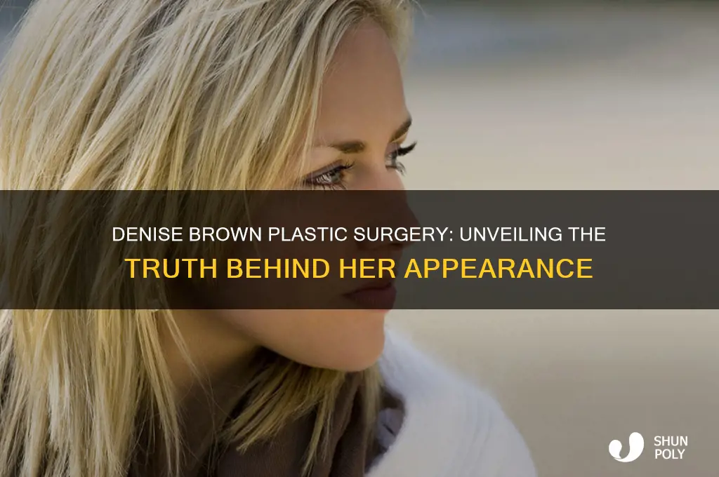 did denise brown have plastic surgery