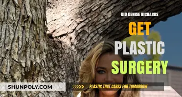 Denise Richards Plastic Surgery: Fact-Checking Her Transformation Rumors