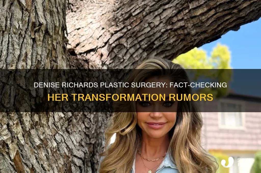did denise richards get plastic surgery