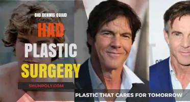 Dennis Quaid's Transformation: Plastic Surgery Speculations and Truths