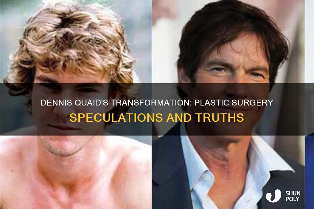 did dennis quaid had plastic surgery