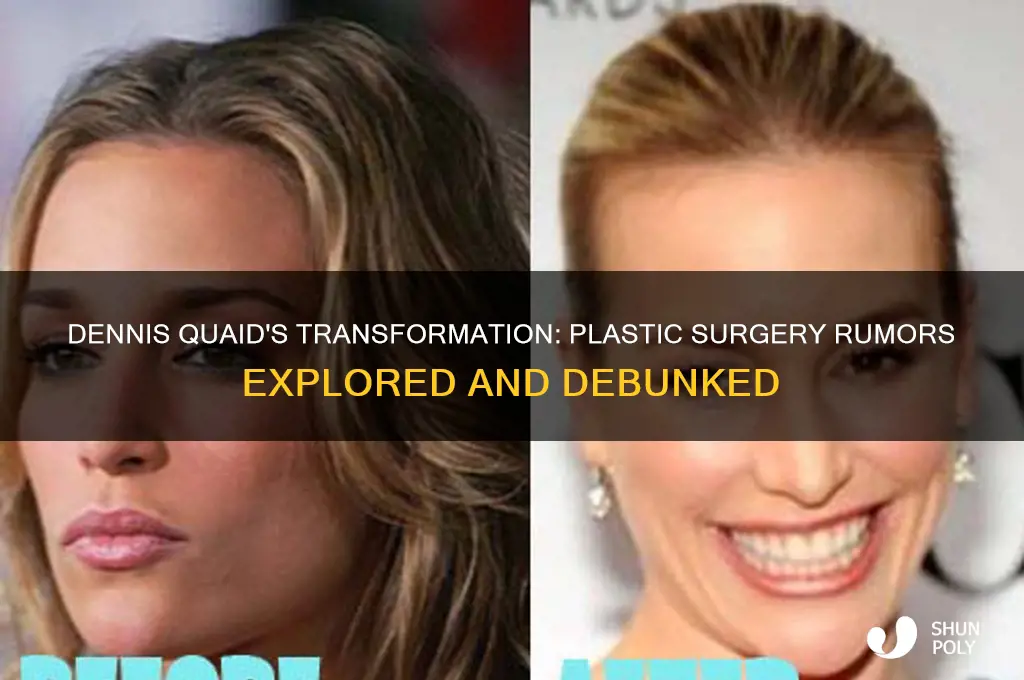 did dennis quaid have plastic surgery
