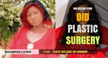 Did Destiny Etiko Undergo Plastic Surgery? Unraveling the Truth