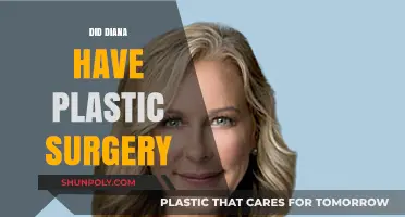 Unveiling the Truth: Did Diana Undergo Plastic Surgery?