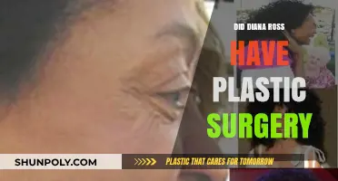 Diana Ross Plastic Surgery: Fact-Checking the Rumors and Speculations