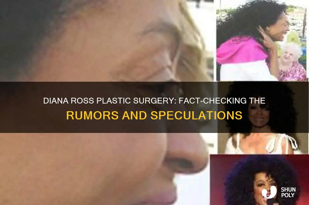 did diana ross have plastic surgery