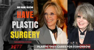 Diane Keaton's Ageless Beauty: Plastic Surgery Rumors Explored