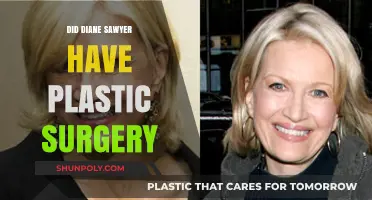Diane Sawyer's Transformation: Plastic Surgery Speculations and Facts Revealed