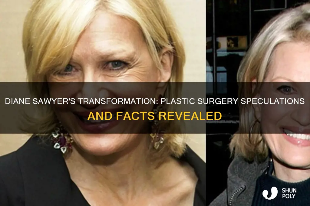did diane sawyer have plastic surgery