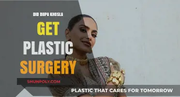 Did Diipa Khosla Undergo Plastic Surgery? Unveiling the Truth