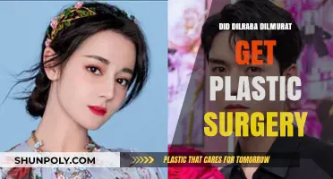 Dilraba Dilmurat's Transformation: Plastic Surgery Rumors Explored