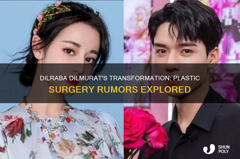 did dilraba dilmurat get plastic surgery
