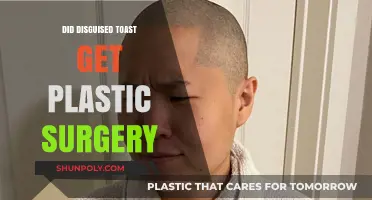 Did Disguised Toast Undergo Plastic Surgery? Unveiling the Truth