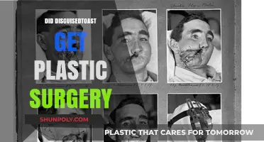 Did DisguisedToast Undergo Plastic Surgery? Unveiling the Truth Behind the Rumors