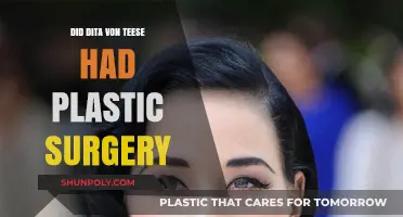 Dita Von Teese Plastic Surgery: Fact or Fiction?