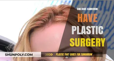 Dive Cameron Plastic Surgery: Fact-Checking the Transformation Rumors