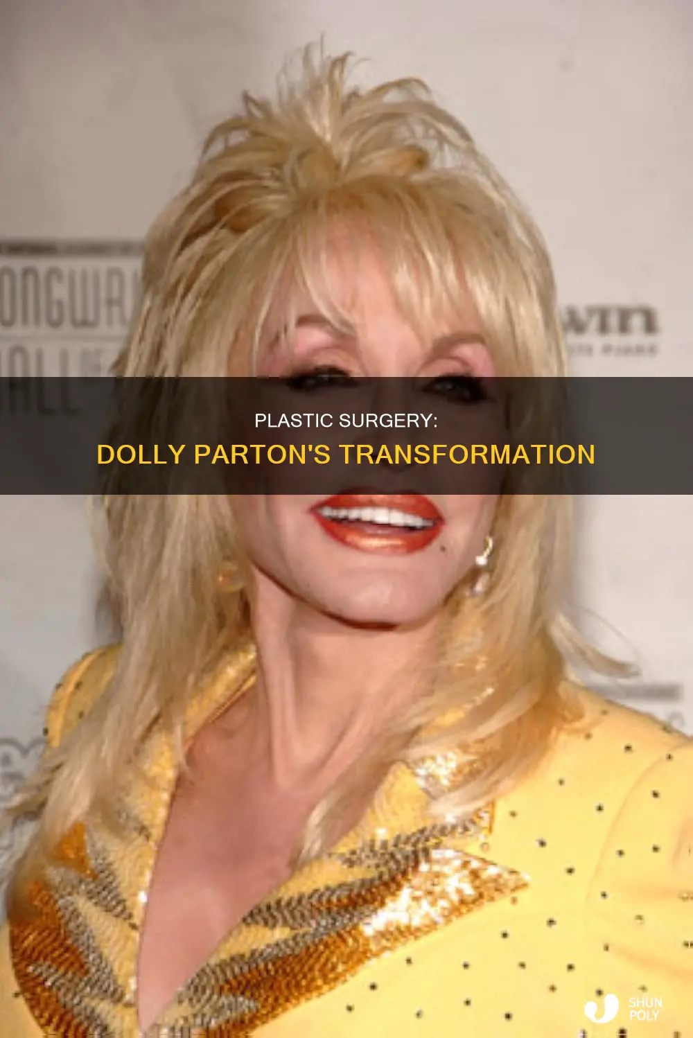 did dolly parton have plastic surgury