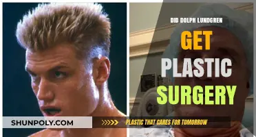 Dolph Lundgren's Transformation: Plastic Surgery Rumors Explored
