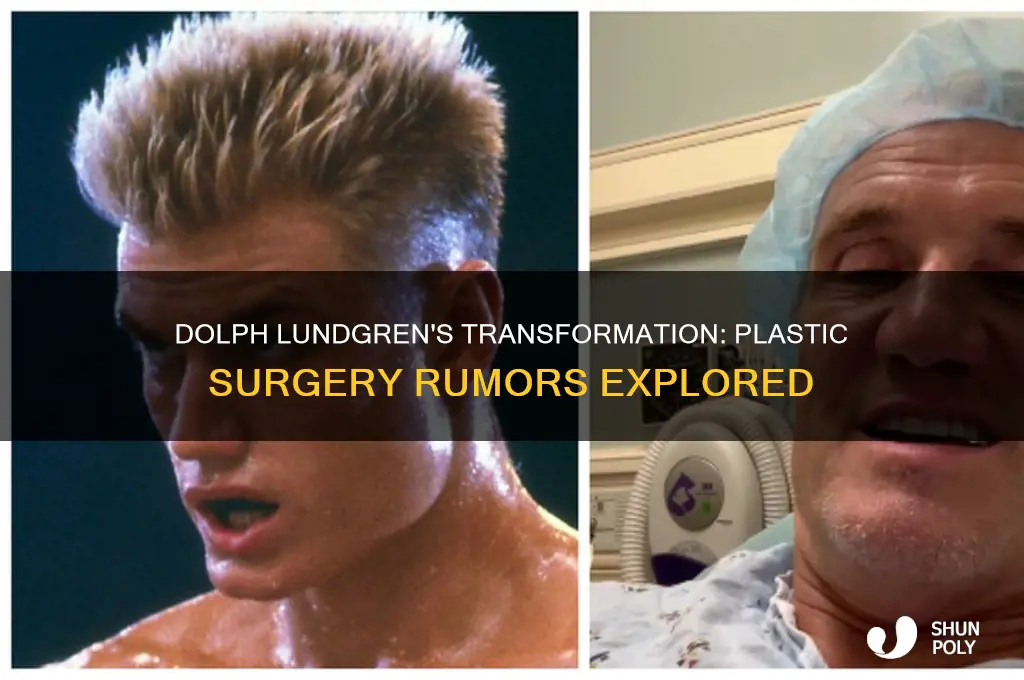 did dolph lundgren get plastic surgery